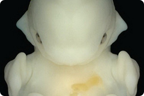 Эмбриончики летучей мыши
